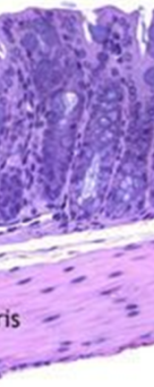 <p>identify the layers in this structure top to bottom (colon)</p>