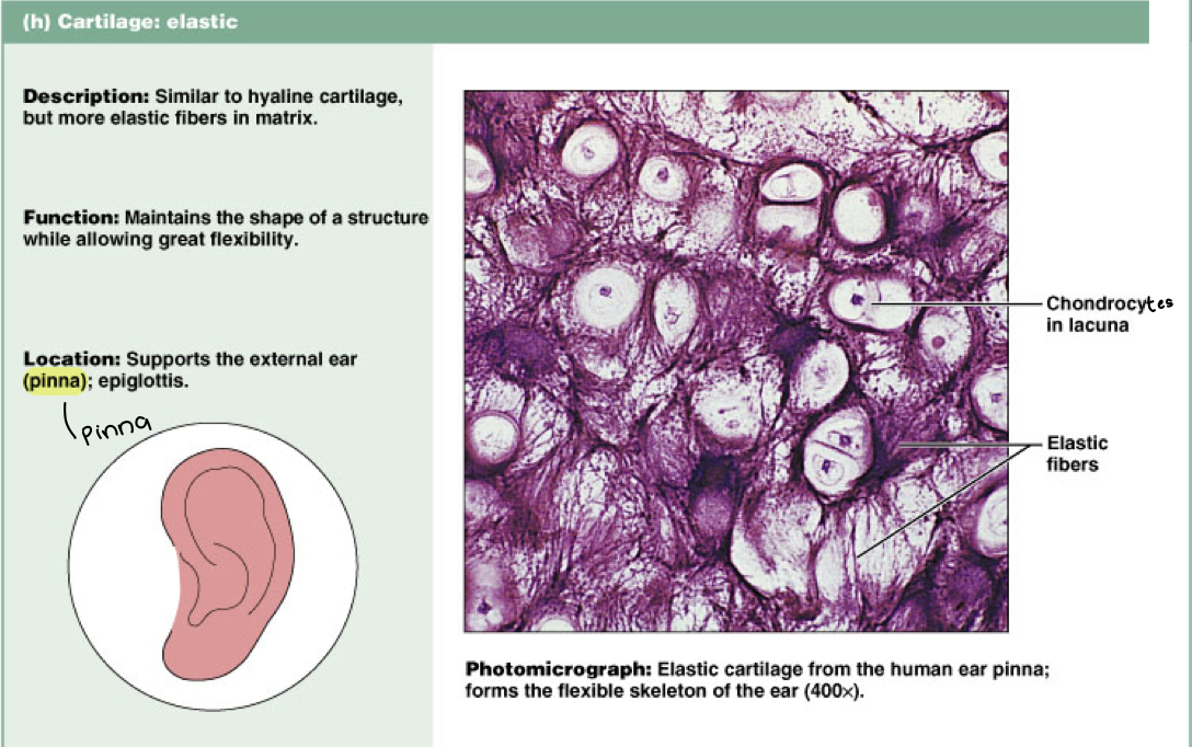 <p>Elastic cartilage (connective)</p><p>Function: maintains the shape of a structure while allowing great flexibility</p><p>Found in the external ear (pinna)</p>