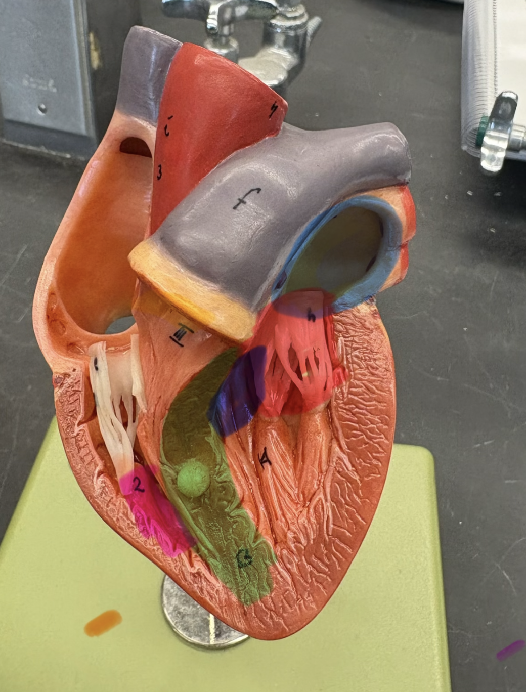 <p>What is located under the pulmonary trunk?</p>