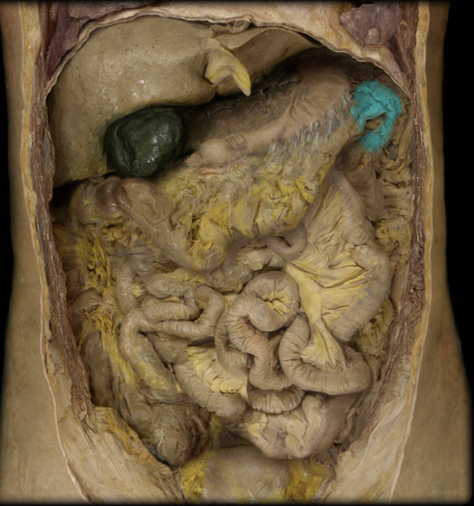 term image