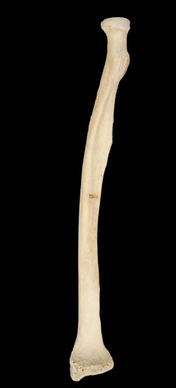 <p>anterior view, right side</p>