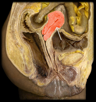 <p>identify the organ highlighted.</p>