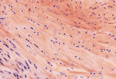 <p>Fibrocartilage </p>