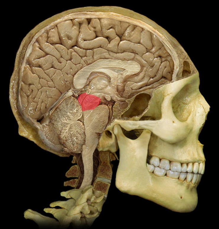 term image