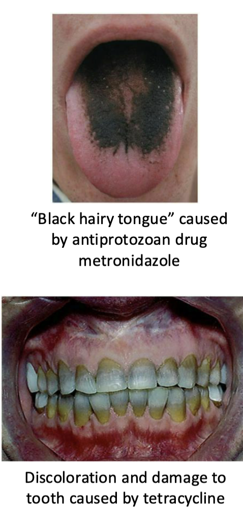<p><strong><u>Toxicity</u></strong></p><ul><li><p>Cause of many adverse reactions poorly understood</p></li><li><p>Drugs may be toxic to kidneys, liver, or nerves</p></li><li><p>Consideration needed when prescribing drugs during pregnancy</p></li></ul><p><strong><u>Allergies</u></strong> </p><ul><li><p>Allergic reactions are rare but may be life threatening</p></li><li><p>Anaphylactic shock</p></li></ul><p><strong><u>Disruption of normal microbiota</u></strong></p><ul><li><p>May result in secondary infections</p></li><li><p>Overgrowth of normal flora causes superinfections</p></li><li><p>Of greatest concern for hospitalized patients</p></li></ul><p></p>