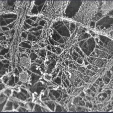 <p><strong>Throughout the cytoplasm</strong>, forming a network around and between organelles</p>