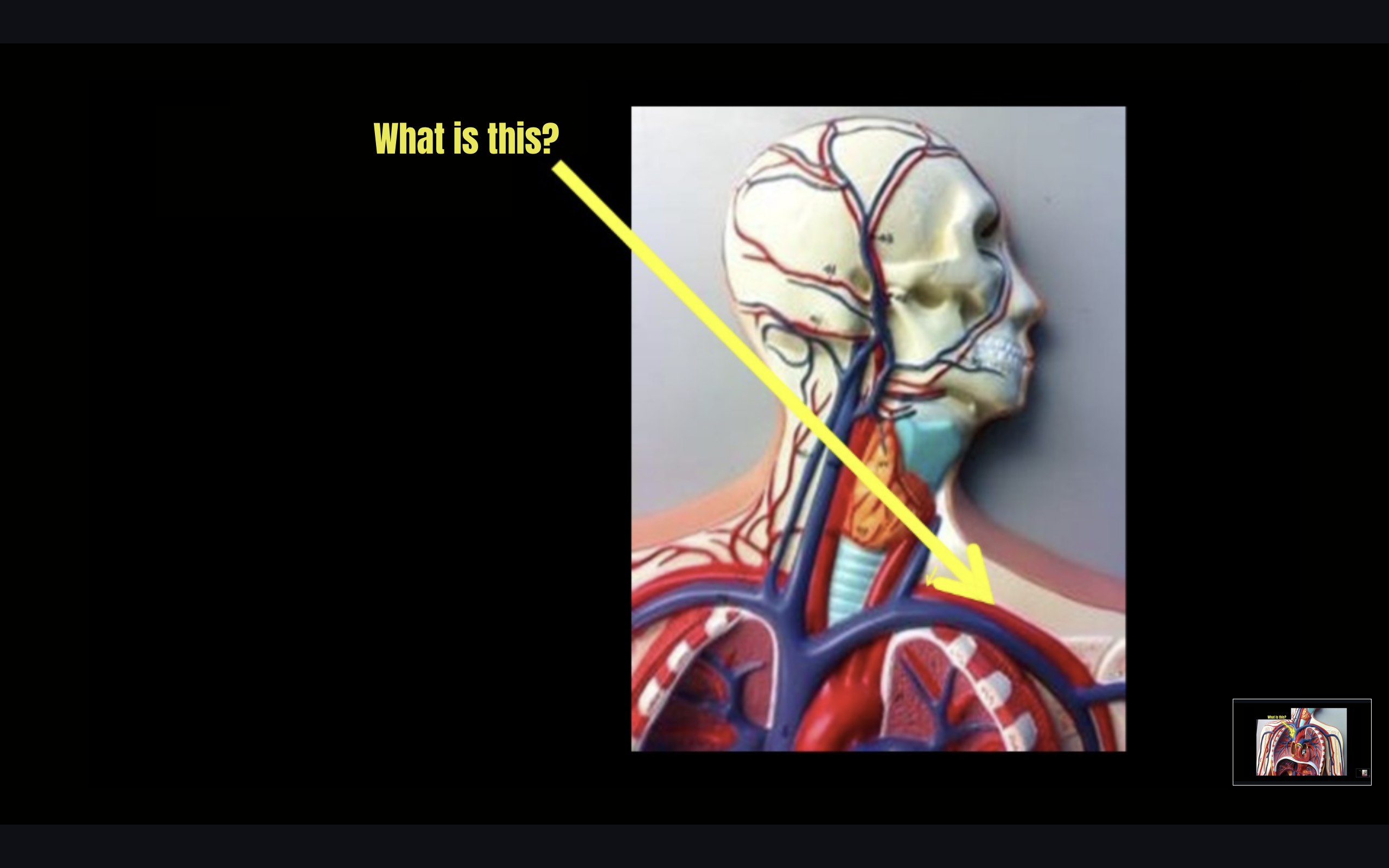 term image