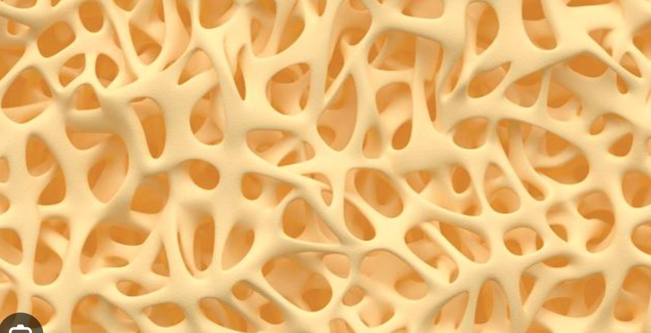<p>Rod like tissue forming spongy texture</p>