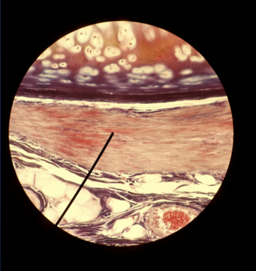 <p>smooth muscle function, location, striated or non-striated, voluntary or involuntary</p>