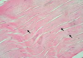 <p>which type of connective tissue is this?</p>
