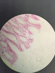 <p>"Leaves on a tree"</p><p>FOUND IN MALE URETHRA AND LARGE EXCRETORY DUCTS OF SOME GLANDS</p>