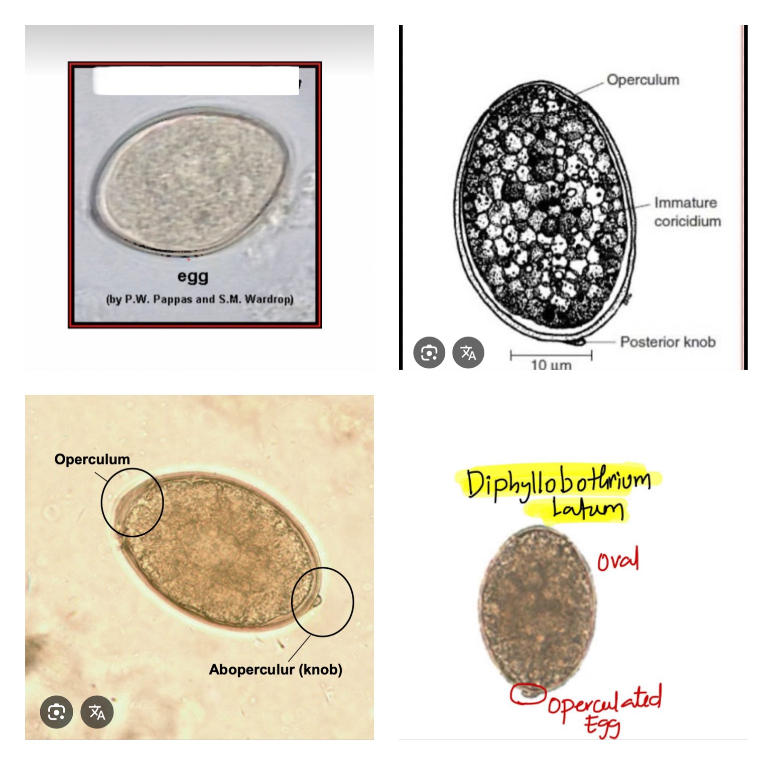 <p><span>Diphyllobothrium latum ova</span></p>