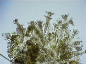 <p>This protozoa can either look like venus fly traps or trumpet shaped, are motile using cilis</p>