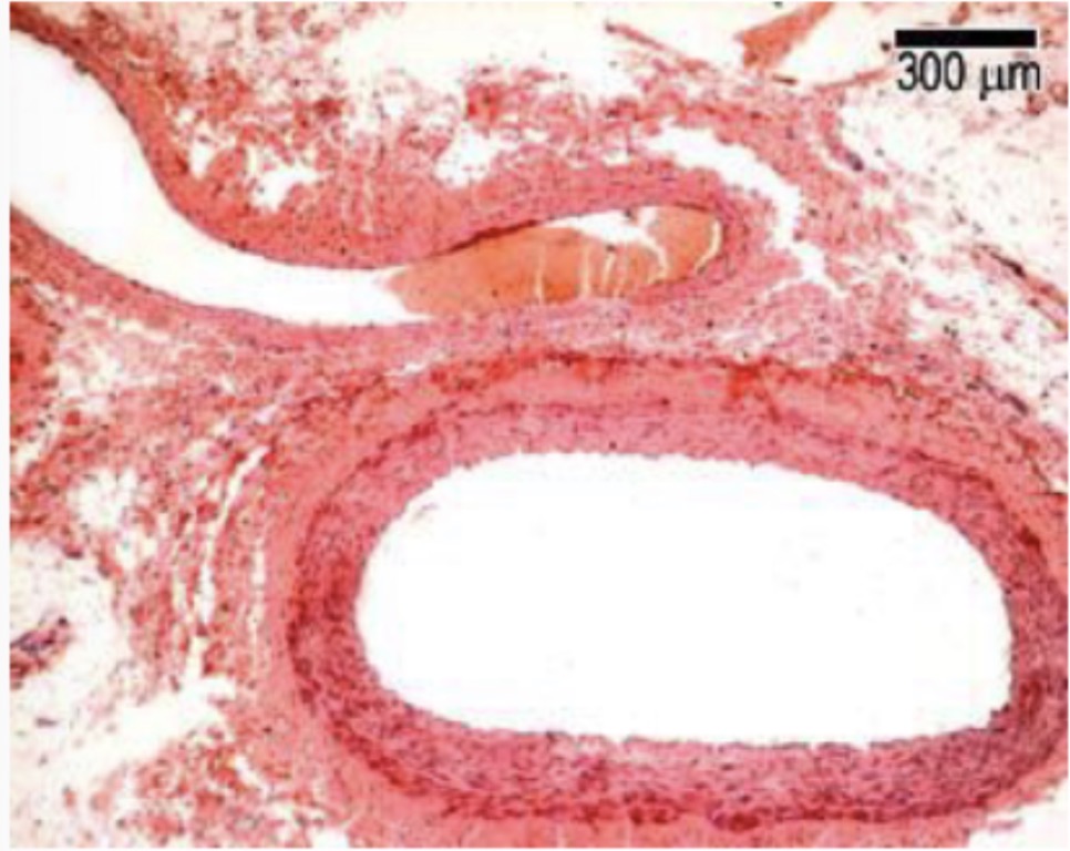 <p>Which one is an artery and which one is a vein?</p>