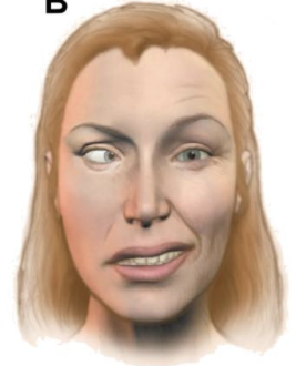 <p>La siguiente imágen corresponde a:</p>