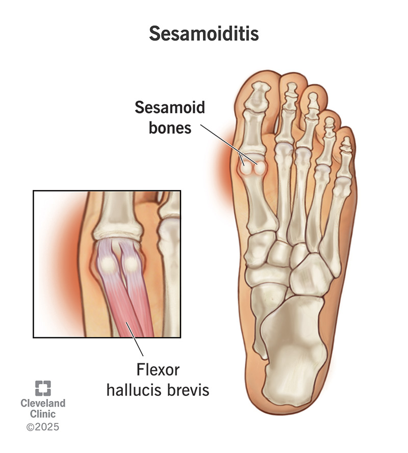 <p>sesamoid bones</p>