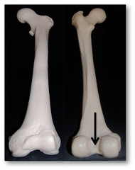 <p>On the back side of the femur</p><p>Name this depression</p>