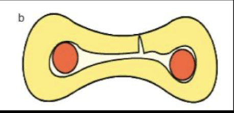 <p>disadvantages of single cone obturation </p>