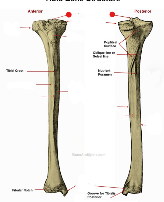 <p>Identify the structure pinned</p>