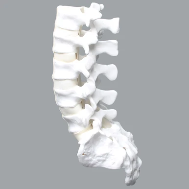 <p>What feature of the Vertebra is this?</p>
