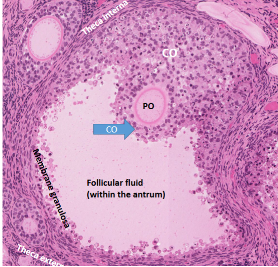 <p>Multiple layers of stratified cuboidal epithelium</p><p>follicular cells outside, oocyte inside</p><p>outer ring is theca interna</p><p></p><p>Graafian follicle: follicular liquid inside, secondary oocyte next to, cumulus oophorus outside both. Membrane granulosa at the end of follicular fluid</p>