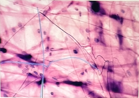 <p>identify the specific tissue in picture</p>