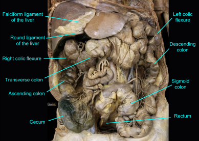<p>large cut up part</p><p>oblong horseshoe crab shaped</p><ul><li><p>structure</p></li></ul><p></p>