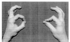 <p>Anterior Interosseous Syndrome (AIN Syndrome)</p>