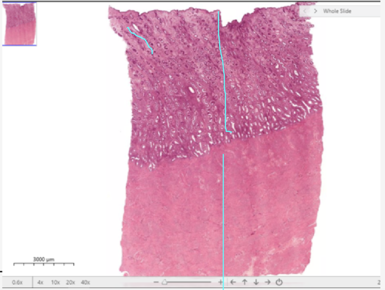 <p>Identify the stage of the organ</p>