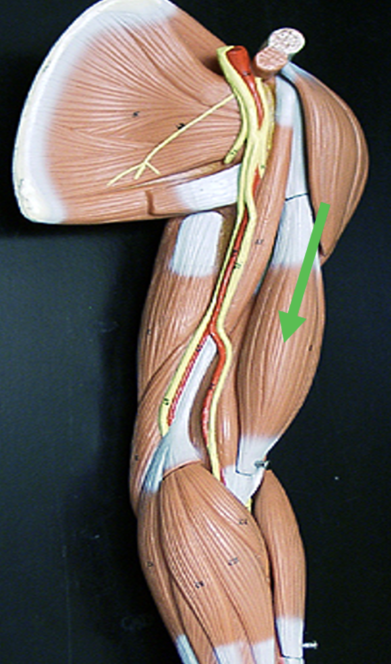 <p>Identify the muscle indicated by the pointer.</p>