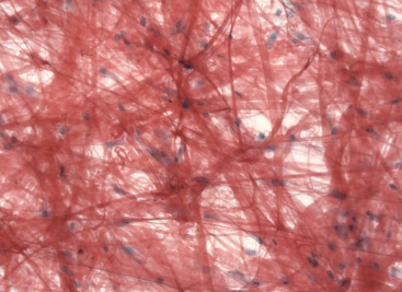 <p>identify the tissue</p>