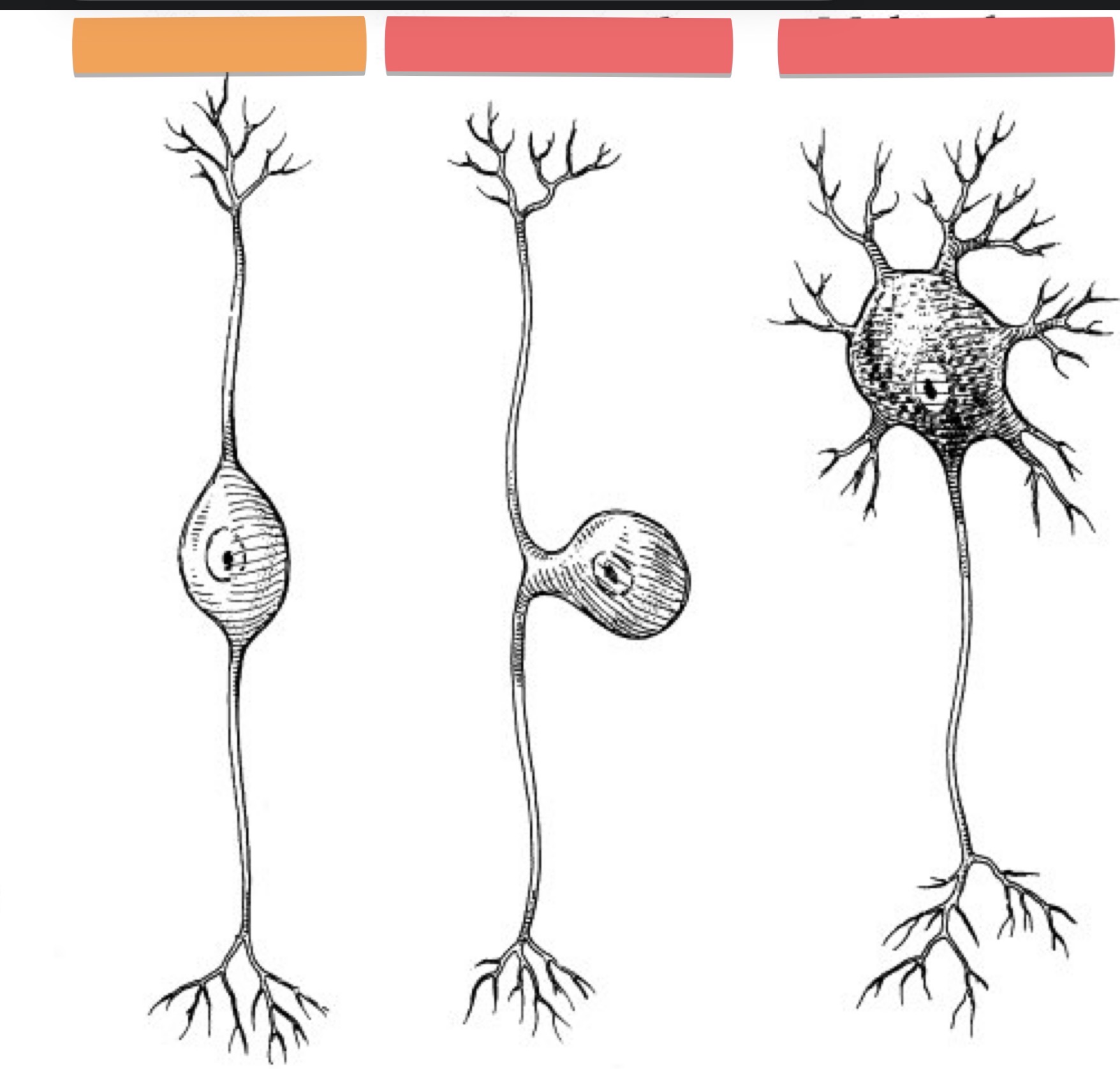 <p>What Neuron is this?</p>