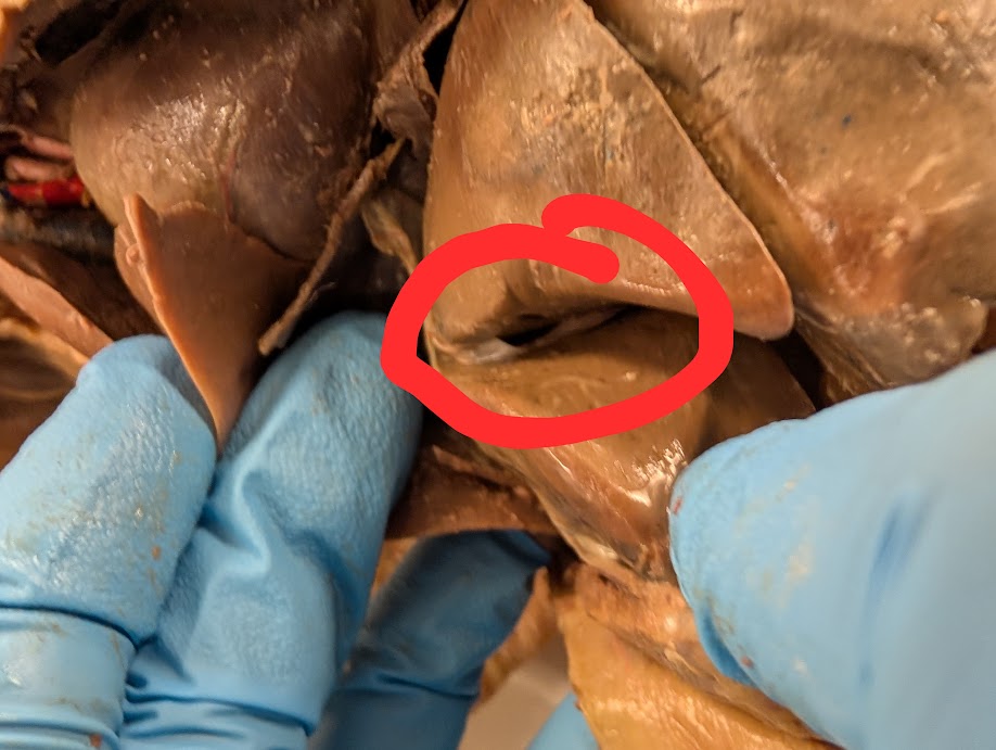 <p>What is circled in red</p>