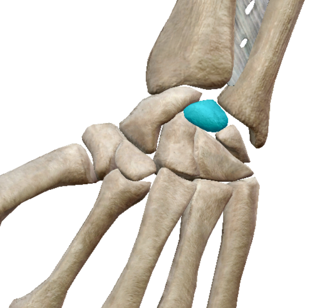 term image