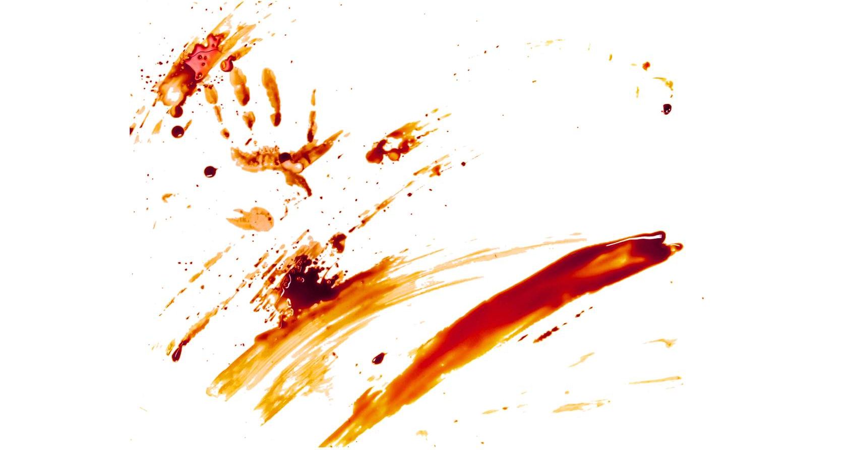 <p>Transfers occur when a blood source comes into contact with a surface. Smudges, smears, or bloody fingerprints or handprints on furniture or doors could indicate a struggle in the room.</p>
