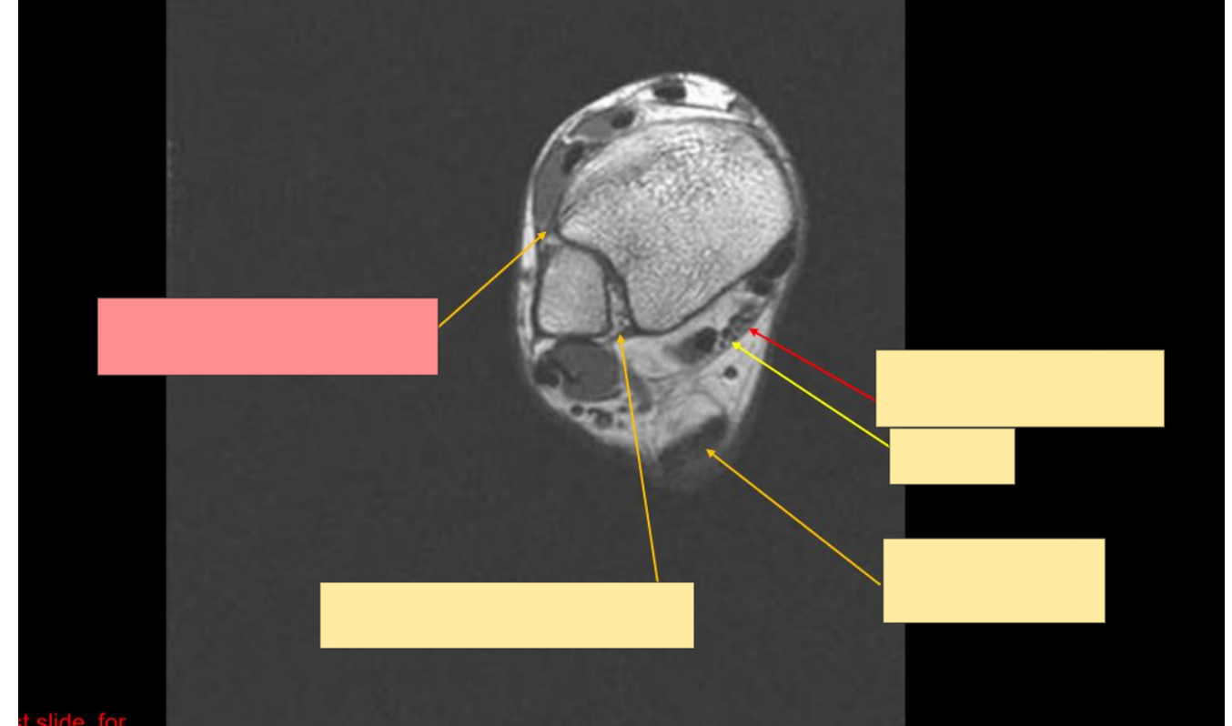 <p>Identify this structure</p>