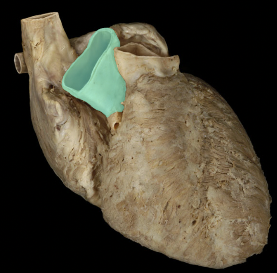 <p>Identify the coronary artery</p>