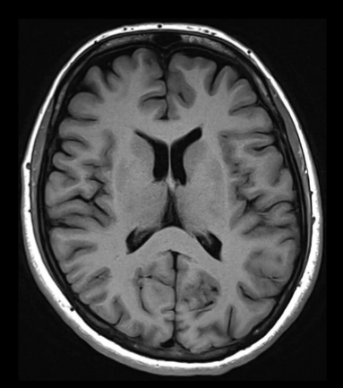 <p>Type of scan, orientation</p>