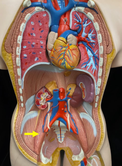 <p>Name the muscle</p>