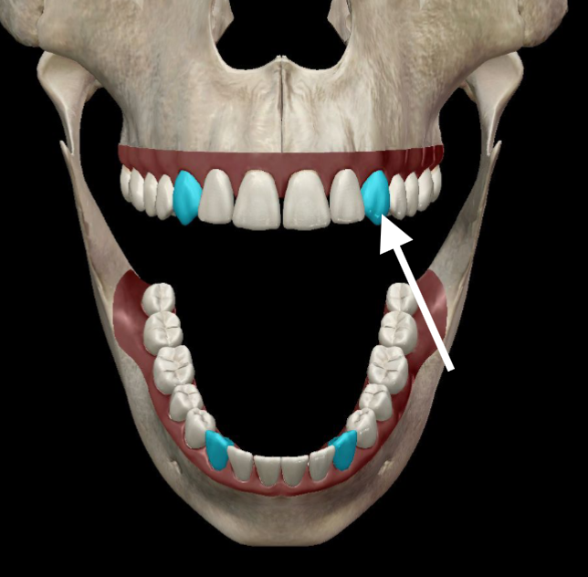 <p>What tooth is this in correct Tooth Notation form?</p>