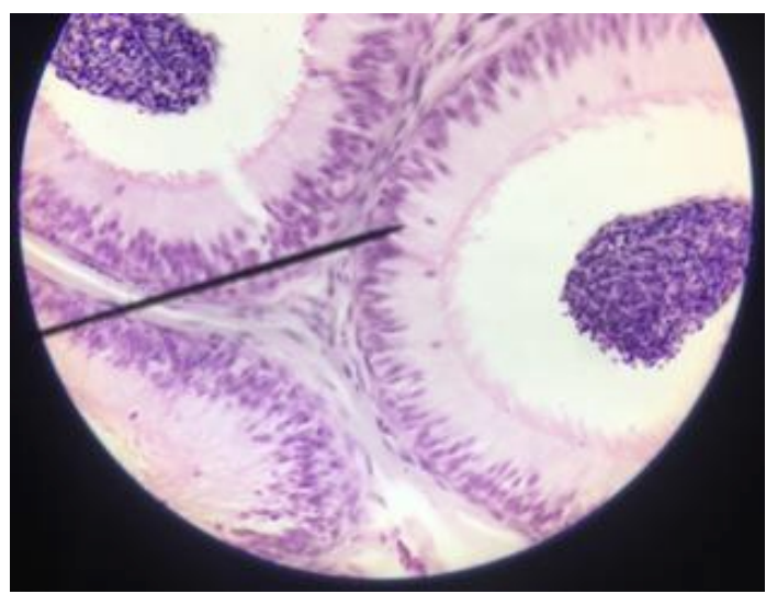 <p>a.) What is this organ?</p><p>b.) What is the parenchyma of the cell?</p><p>c.) How many nucleus?</p><p>d.) What is the stroma?</p><p>e.) What is the arrangement of the cell?</p><p>f.) location of the nucleus?</p><p>g.) Shape?</p>