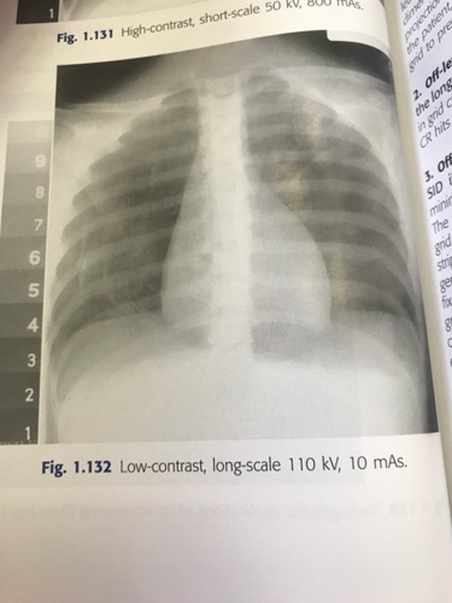 <p>Low contrast -long scale</p>