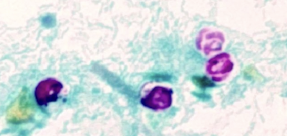 <p>On histology, _________________ are characterized by being <strong>partially acid-fast </strong>cysts that contain FOUR motile sporozoites.</p>