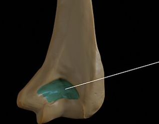 <p>What bone landmark is this within the <strong>Humerus </strong></p>