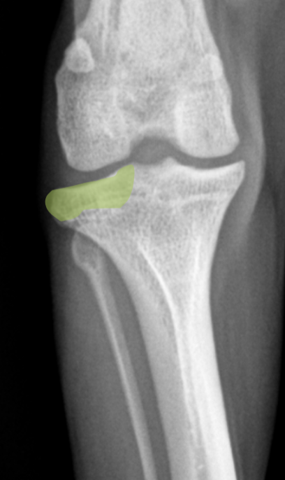 term image