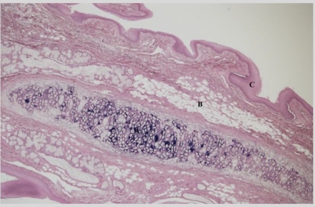 <p>NTK: what type of cartilage is this </p>