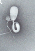 <p>What is this? Normal or abnormal sperm?</p>