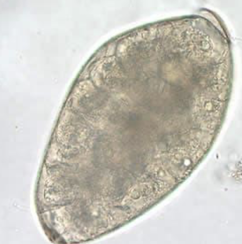 <p>What parasite is this?</p>