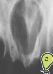 <ol start="80"><li><p>Identify the finding shown.</p></li></ol><p></p>