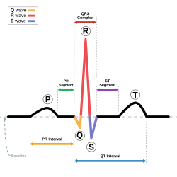 <p>Reflects ventricular depolarization; measured from the beginning of the Q wave to the end of the S wave</p>